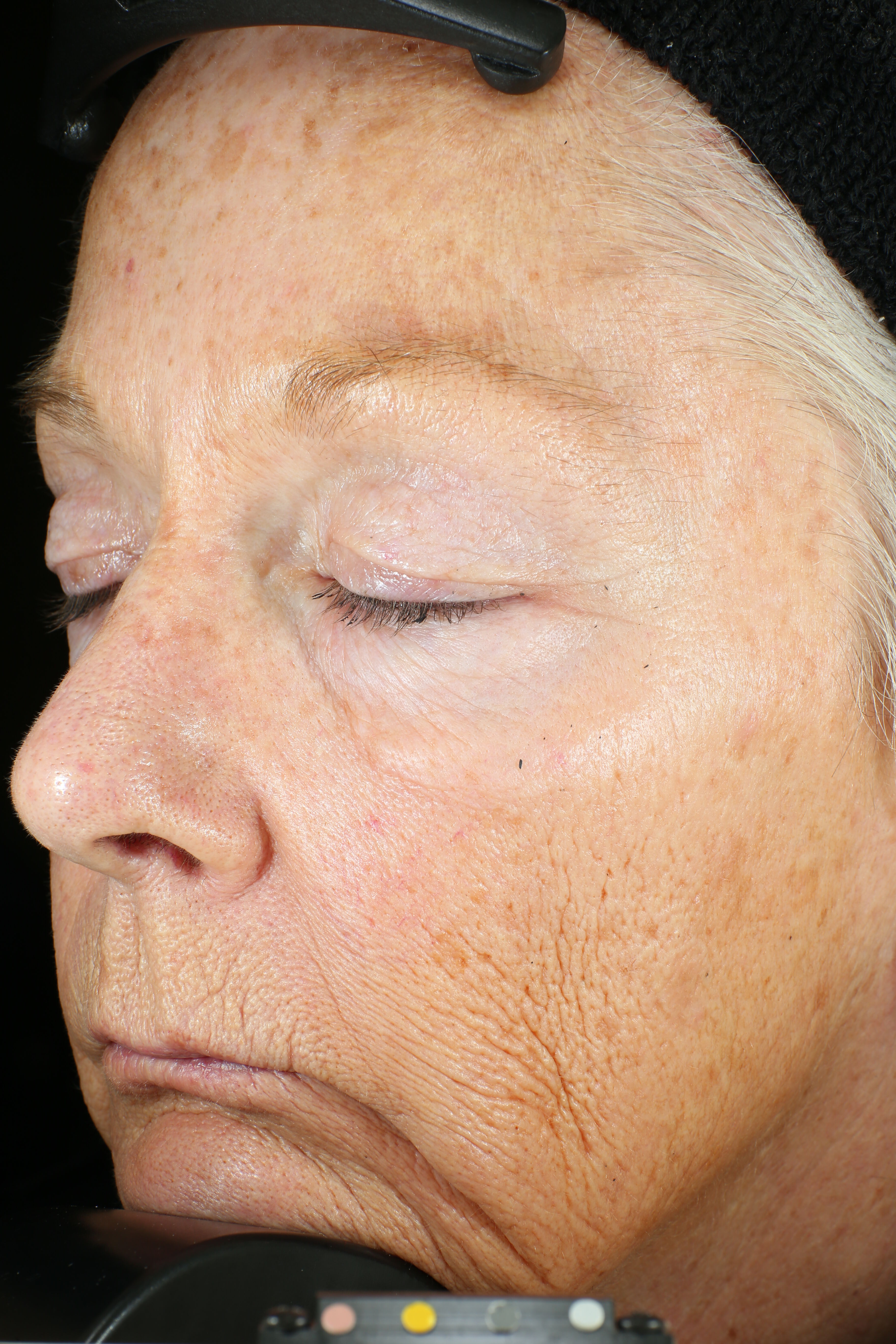 Wrinkle + Texture Repair (travel size)  before-after-1