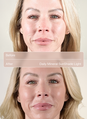 Daily Mineral Sunshade Light Before After 2 image number 7