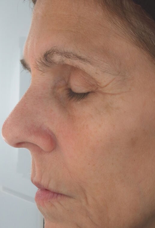 baseline image firming serum