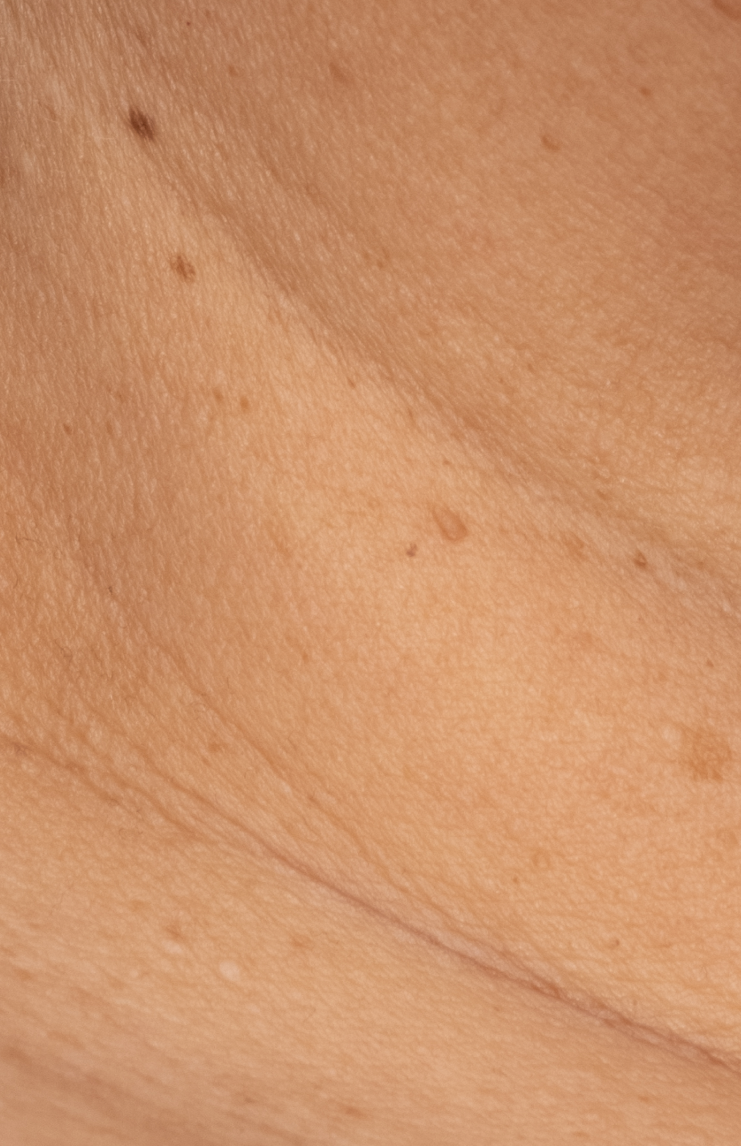 Recovery Cr&egrave;me  before-after-4