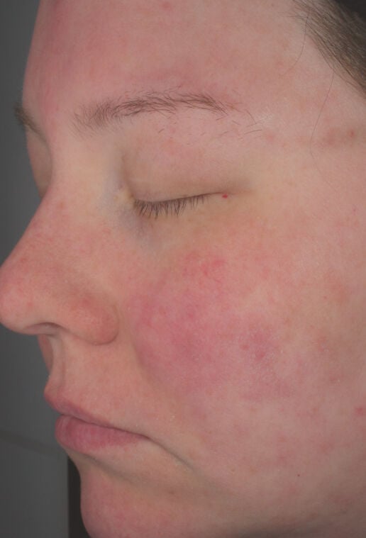 Hydrating Cr&egrave;me (Travel Size)  before-after-2