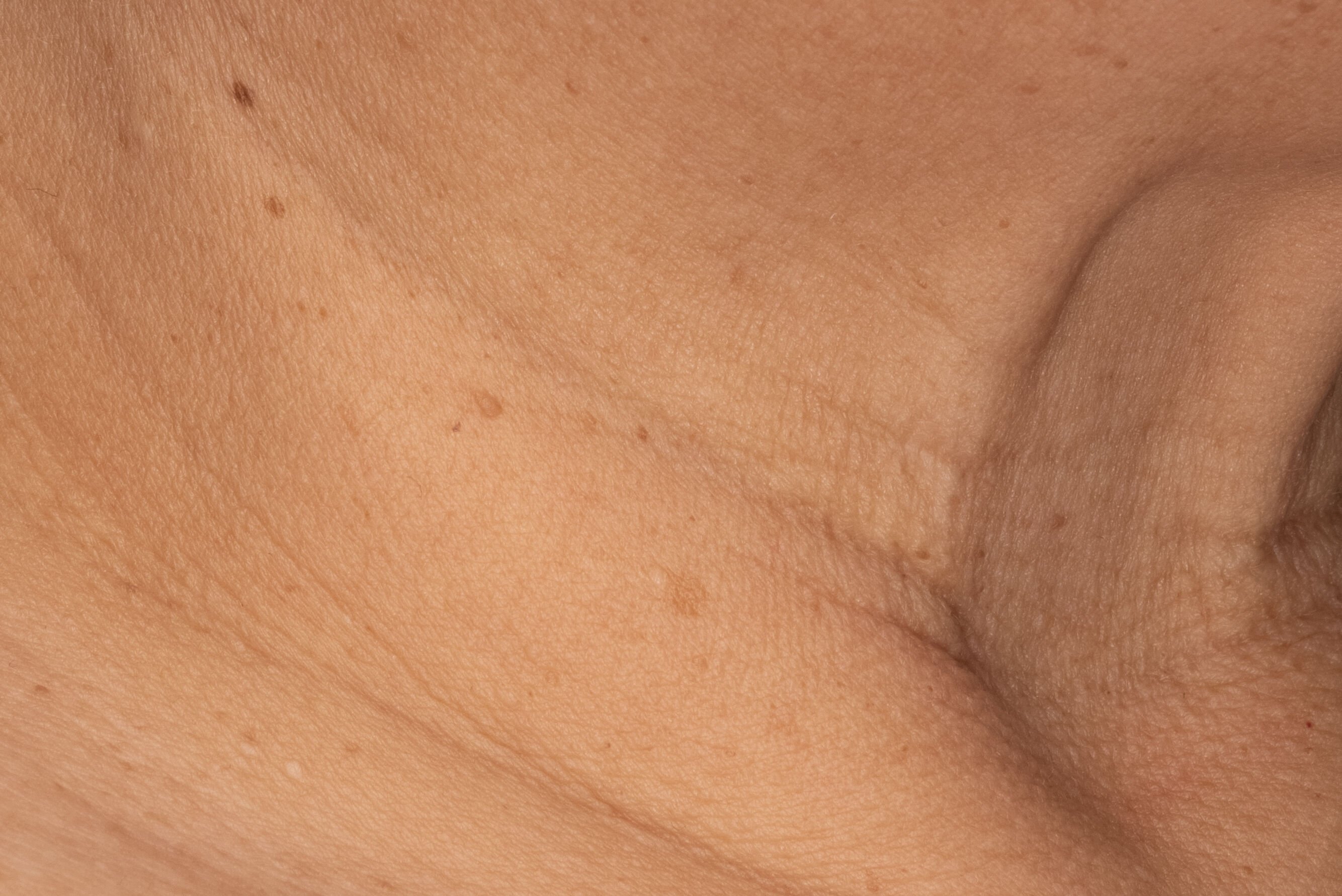 Before and After after 2 weeks of Recovery Crème Usage