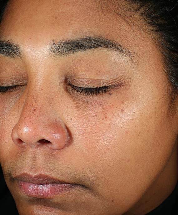 Before and After Image of results from 8 weeks of Daily Power Defense