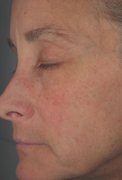 Hydrating Cr&egrave;me (Travel Size)  before-after-3