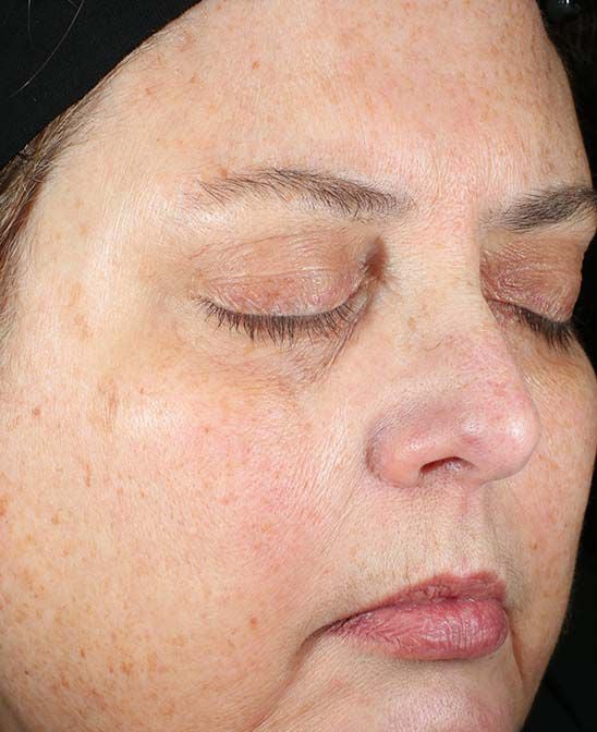 Before and After Image of results from 8 weeks of Daily Power Defense