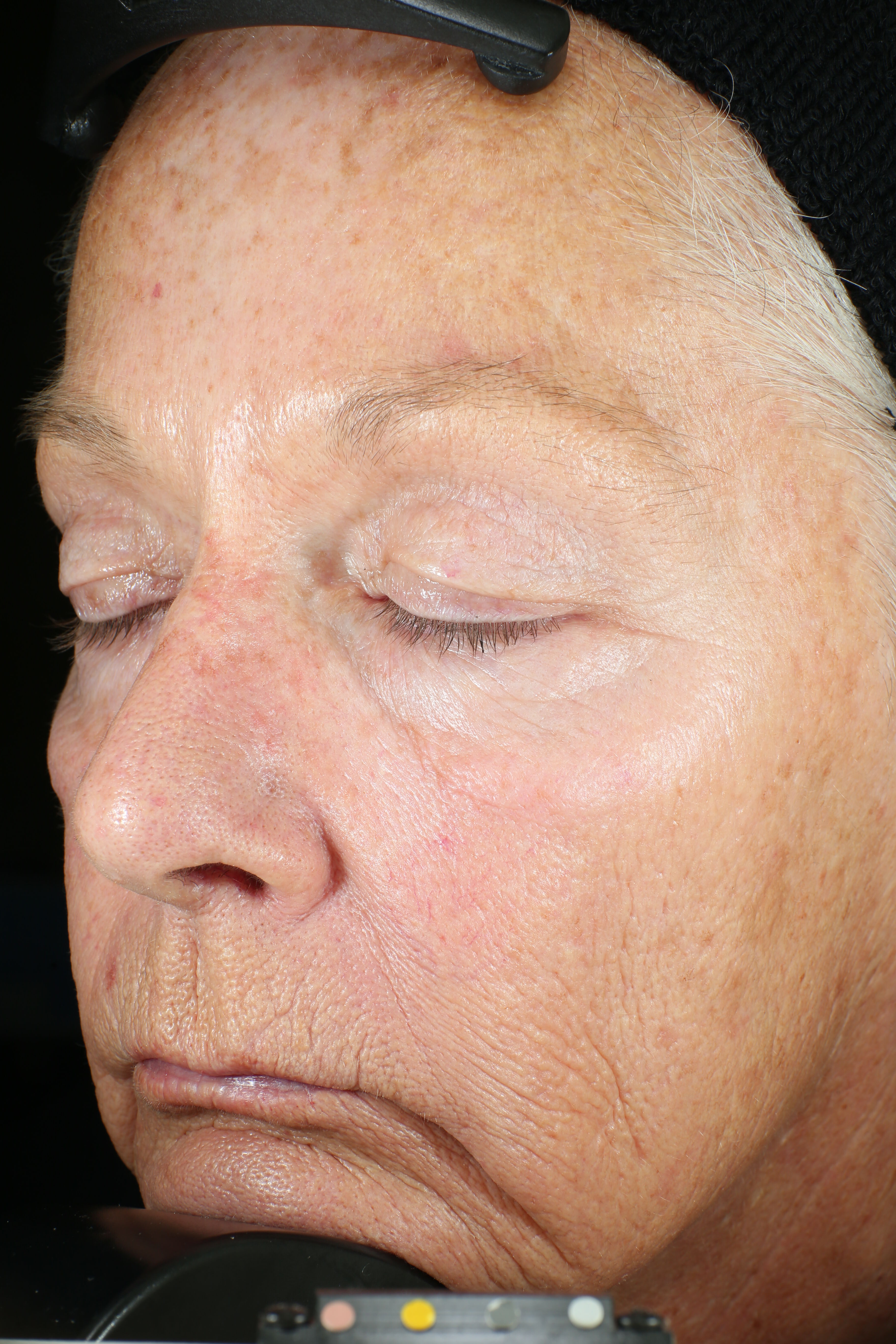Wrinkle + Texture Repair (travel size)  before-after-1