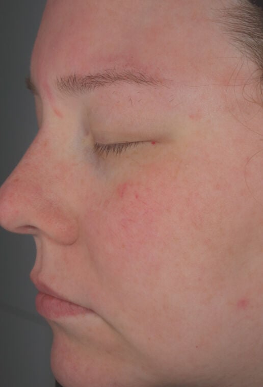 Hydrating Cr&egrave;me (Travel Size)  before-after-2