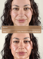 Daily Mineral Sunshade Medium Before After 3 image number 7