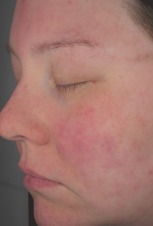 Hydrating Cr&egrave;me  before-after-2