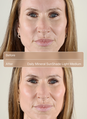 Daily Mineral Sunshad Light Medium Before After 3 image number 8
