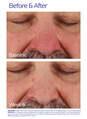 Rozatrol&reg; (Travel Size)  hi-res image number 8