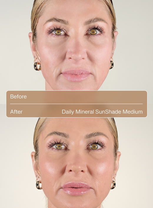 Daily Mineral Sunshade Medium Before After 2 image number 6
