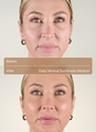 Daily Mineral Sunshade Medium Before After 2 image number 6