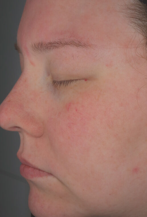Hydrating Cr&egrave;me  before-after-2